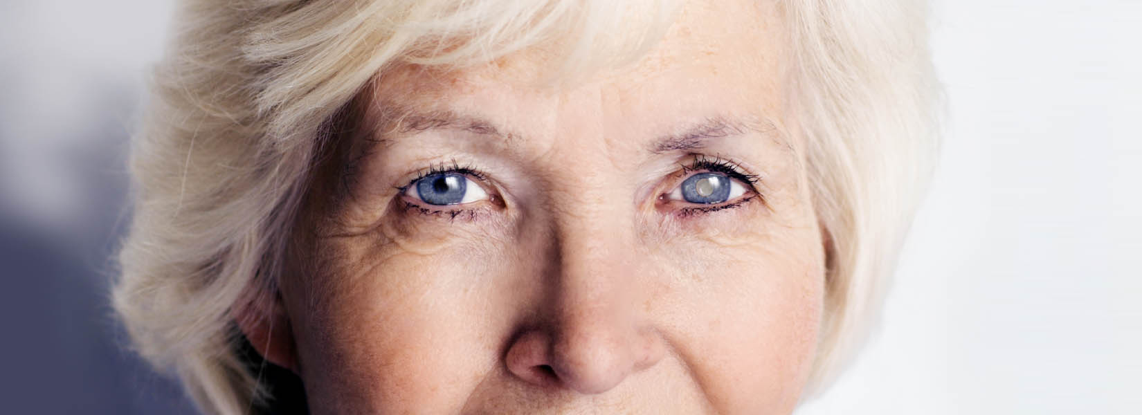 Cataract Surgery in Cimarron